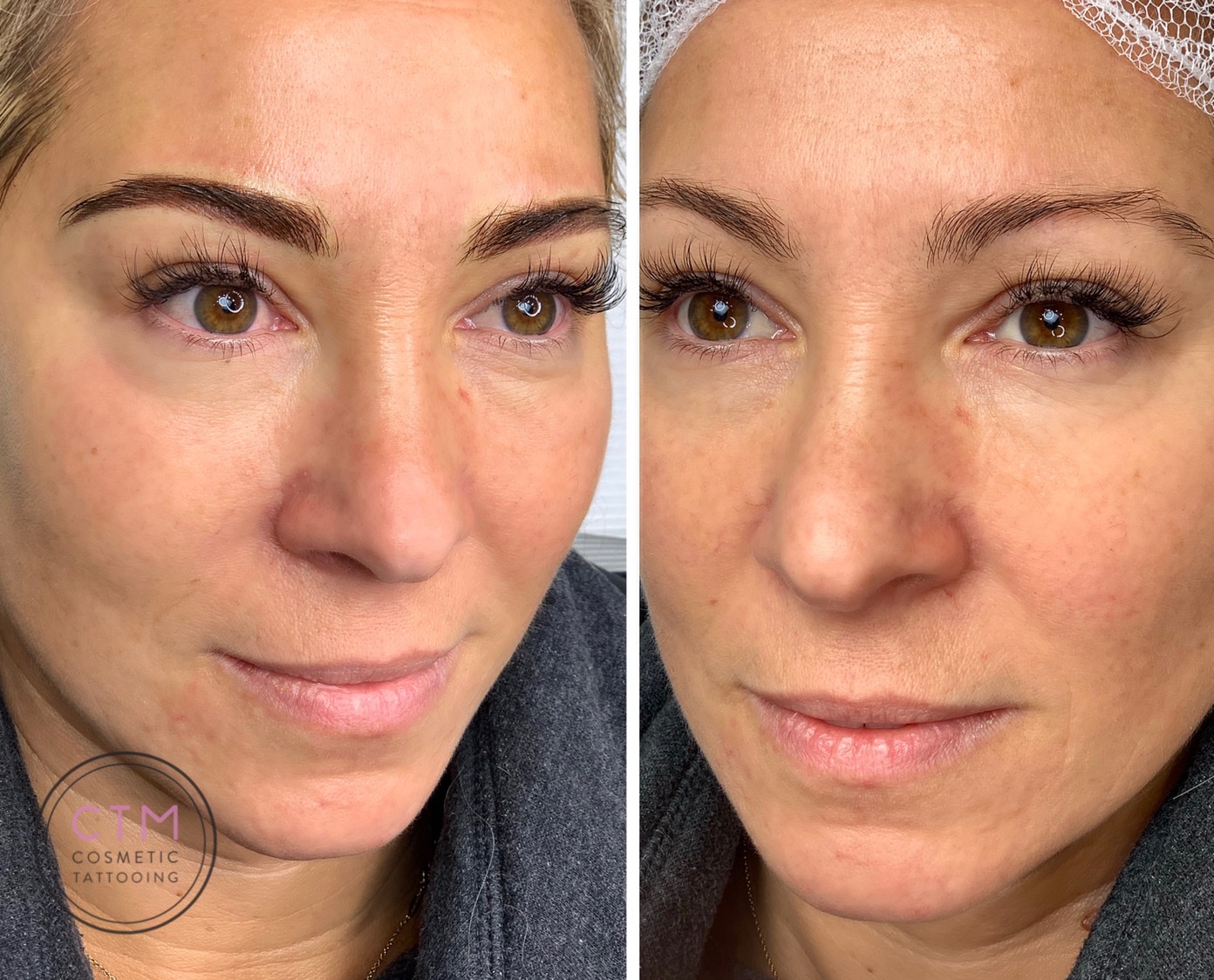 Combination brows tattoo before and after – Cosmetic Tattooing Melbourne, St Kilda