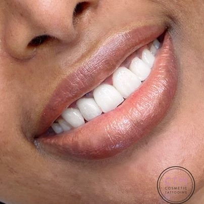 Cosmetic Teeth Whitening Melbourne