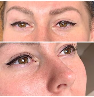 Permanent Eyeliner Tattoos in Melbourne