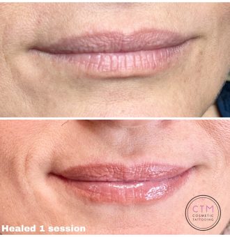 Melbourne Cosmetic Lip Tattoo