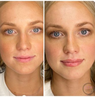 Cosmetic Lip Tattoo Melbourne