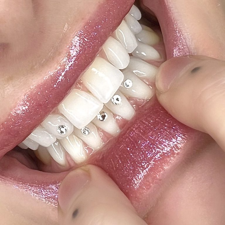 Tooth Gems Melbourne  Cosmetic Tattooing Melbourne