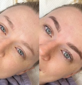 Brow tattoo before and after, cosmetic tattooing melbourne