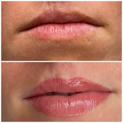 Mature Lips