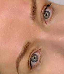 eye
