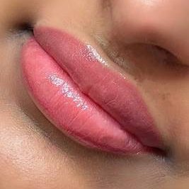 Lip-Neutralization-n