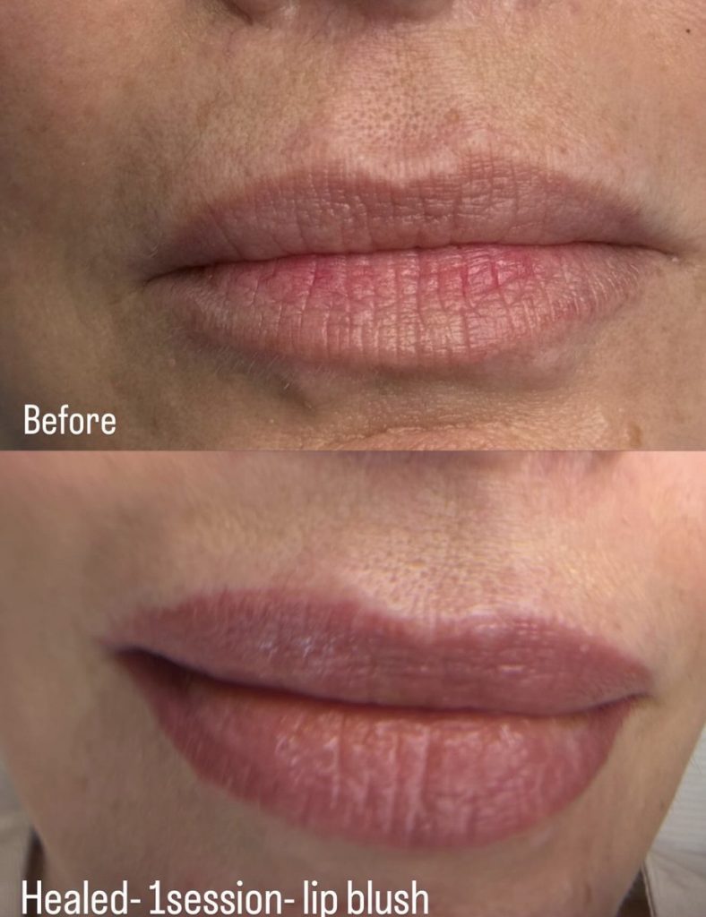 Lip blush tattoo before and after – Cosmetic Tattooing Melbourne, St Kilda