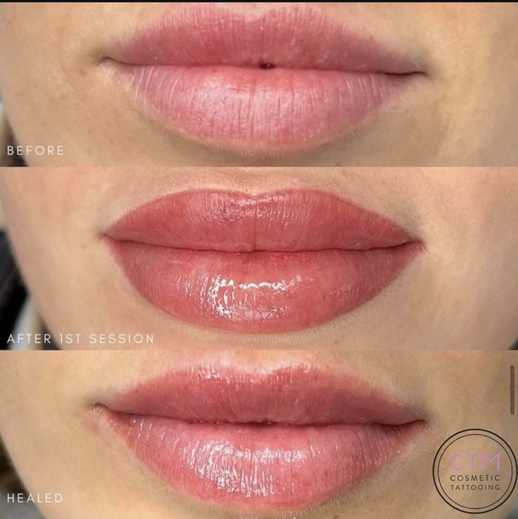 Lip blush tattoo before and after – Cosmetic Tattooing Melbourne, St Kilda