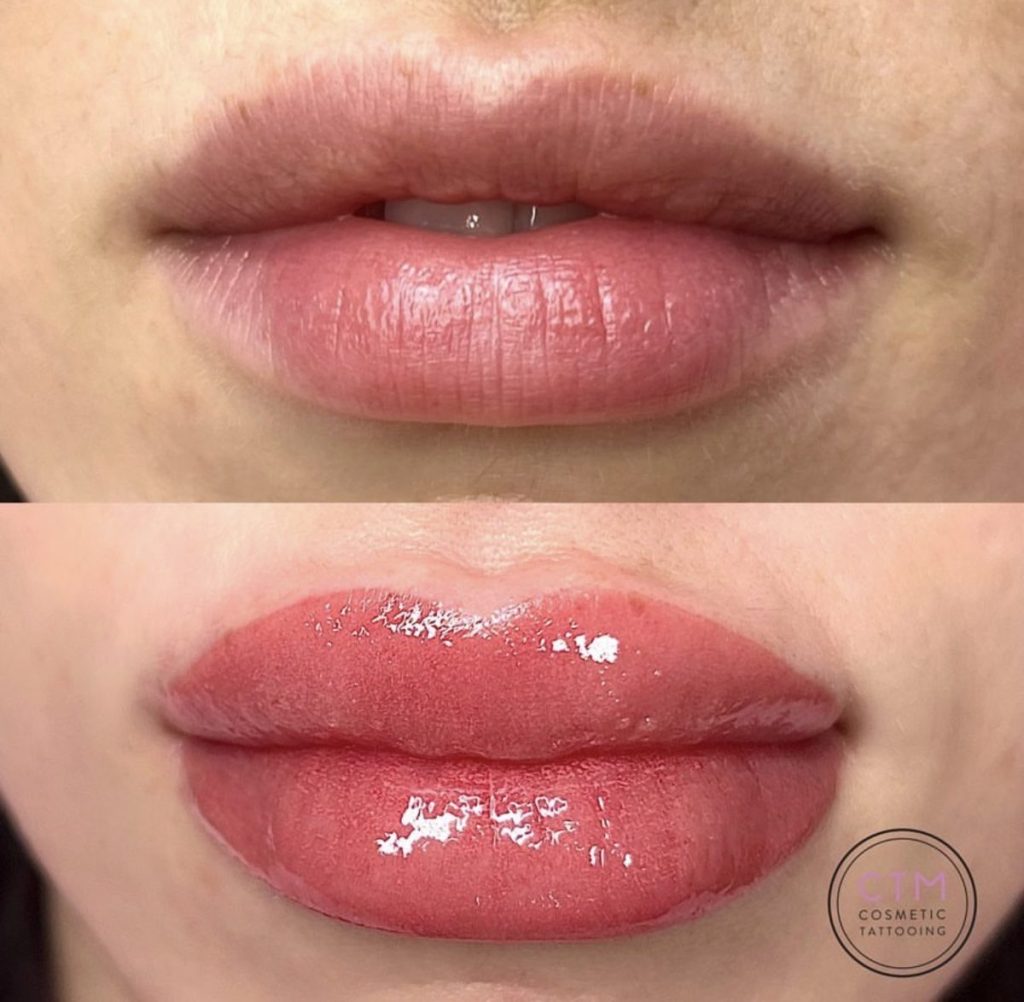 Lip blush tattoo before and after – Cosmetic Tattooing Melbourne, St Kilda