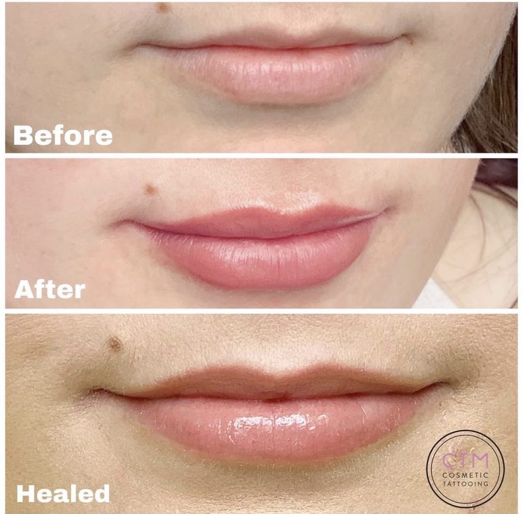 Lip blush tattoo before and after – Cosmetic Tattooing Melbourne, St Kilda