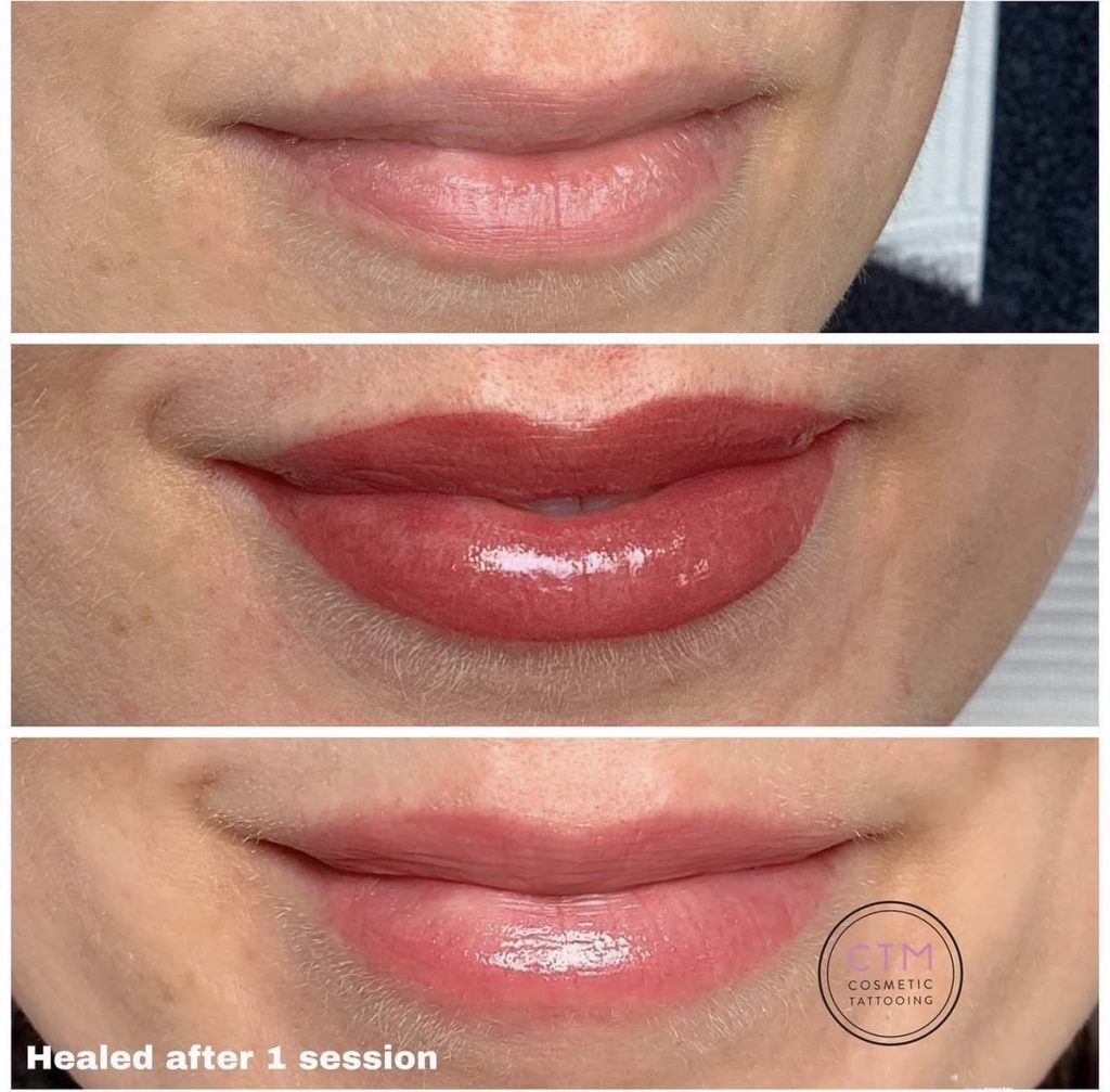 Lip blush tattoo before and after – Cosmetic Tattooing Melbourne, St Kilda