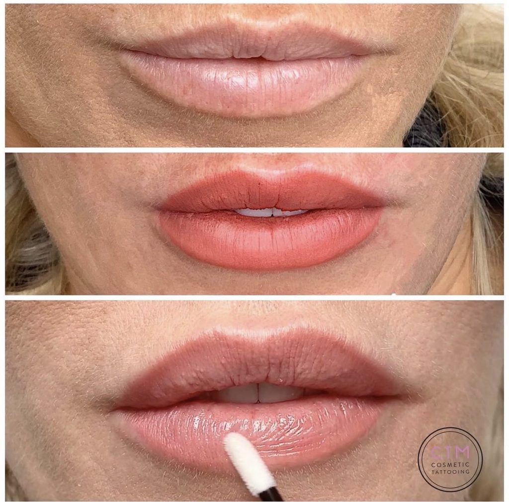 Lip blush tattoo before and after – Cosmetic Tattooing Melbourne, St Kilda