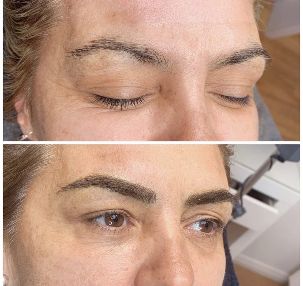 Microblading before and after – Cosmetic Tattooing Melbourne