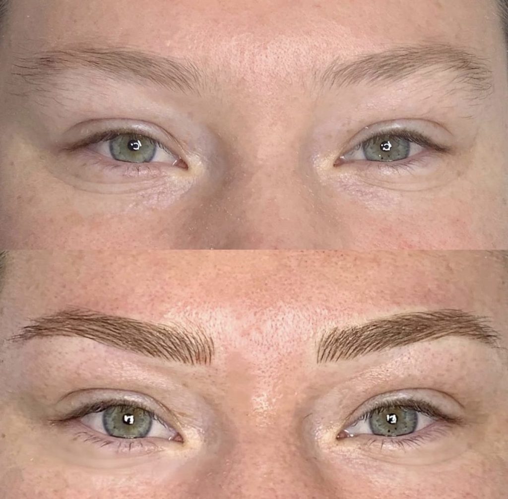 Microblading brows before and after – St Kilda, Melbourne