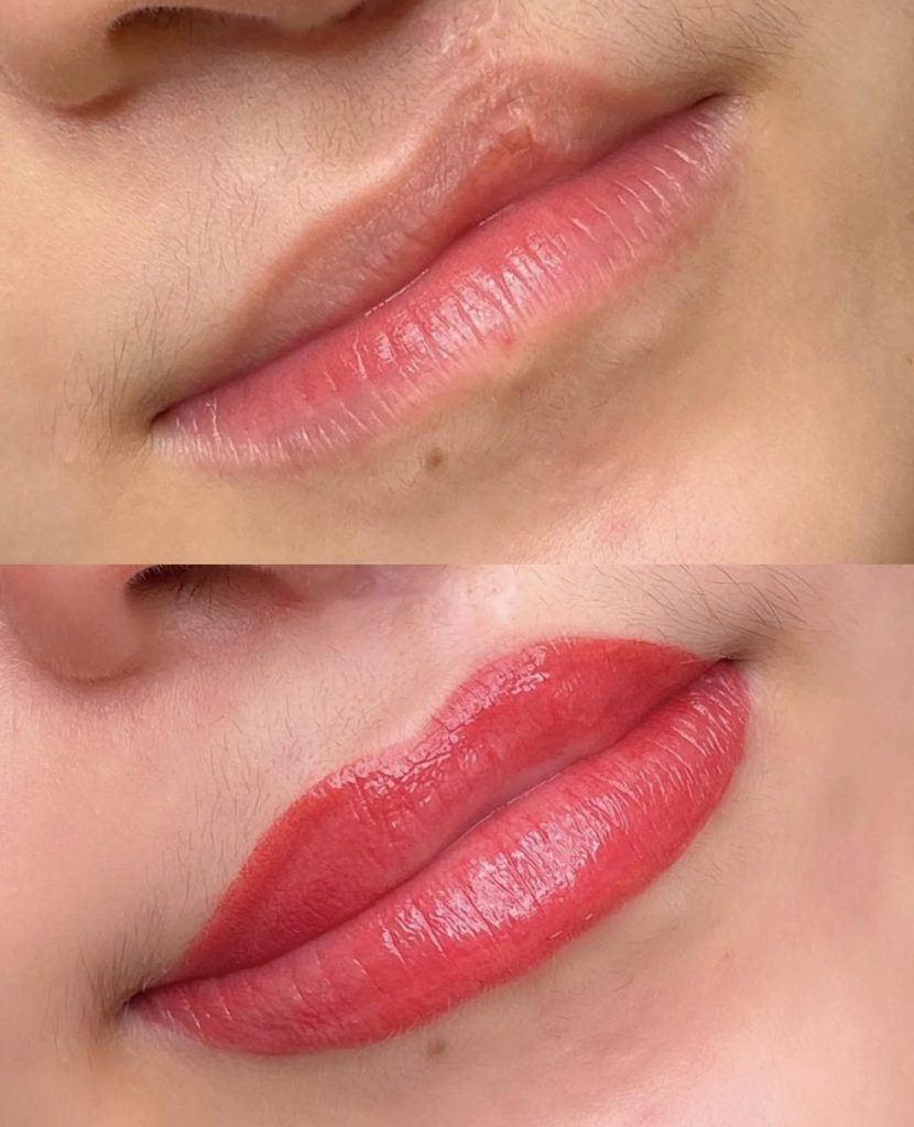 Reconstructive lip tattoo before and after – Cosmetic Tattooing Melbourne, St Kilda