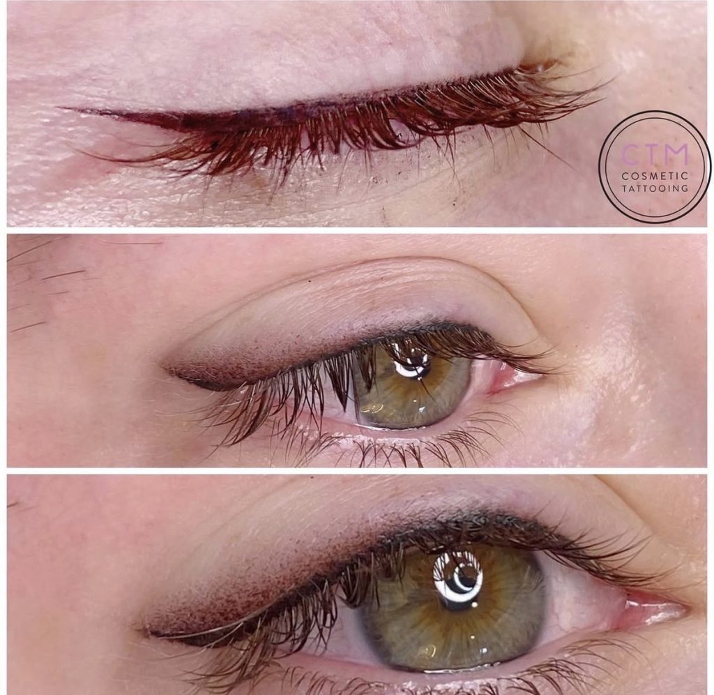Winged eyeliner tattoo before and after – Cosmetic Tattooing Melbourne, St Kilda