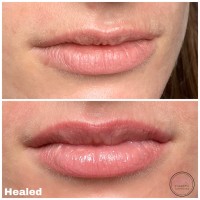 {"source_sid":"2BACD3F5-7BB9-4BEF-9435-9752FBF2E95B_1586679905561","subsource":"done_button","uid":"2BACD3F5-7BB9-4BEF-9435-9752FBF2E95B_1586679905560","source":"other","origin":"gallery"}