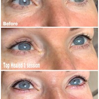 Eyeliner Tattoos