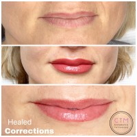 Cosmetic Lip Tattoo