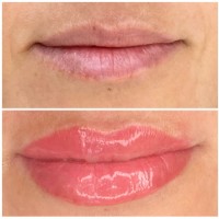 {"subsource":"done_button","uid":"2BACD3F5-7BB9-4BEF-9435-9752FBF2E95B_1610932767772","source":"other","origin":"unknown","source_sid":"2BACD3F5-7BB9-4BEF-9435-9752FBF2E95B_1610932801252"}