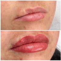 {"subsource":"done_button","uid":"2BACD3F5-7BB9-4BEF-9435-9752FBF2E95B_1609381786172","source":"other","origin":"unknown","source_sid":"2BACD3F5-7BB9-4BEF-9435-9752FBF2E95B_1609381807891"}