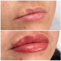 {"subsource":"done_button","uid":"2BACD3F5-7BB9-4BEF-9435-9752FBF2E95B_1609381786172","source":"other","origin":"unknown","source_sid":"2BACD3F5-7BB9-4BEF-9435-9752FBF2E95B_1609381807891"}