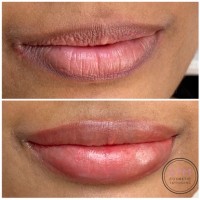 Lip Tattoos Melbourne
