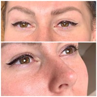 Permanent Eyeliner Tattoos in Melbourne