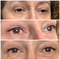 Permanent Eyeliner Melbourne