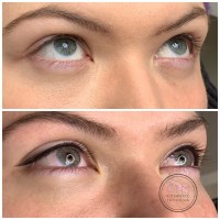 Eyeliner Tattooing Melbourne