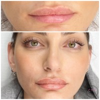 Lip Tattoo Melbourne