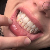melbourne tooth gems
