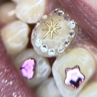 melbourne tooth gems