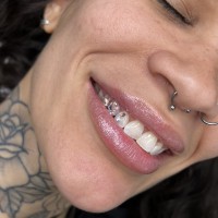 melbourne tooth gems
