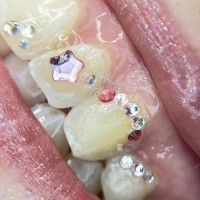 Melbourne tooth gems