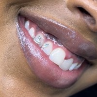melbourne tooth gems