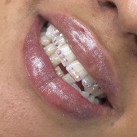 melbourne toothgems